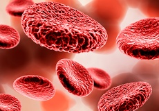 Schematische Darstellung einer Sepsis im Blutbild